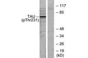 Western blot analysis of extracts from MDA-MB-435 cells, using Tau (Phospho-Thr231) Antibody. (tau anticorps  (pThr548))