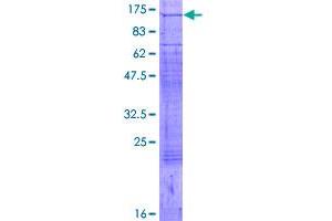 Image no. 1 for ATPase, Ca++ Transporting, Cardiac Muscle, Fast Twitch 1 (ATP2A1) (AA 1-994) protein (GST tag) (ABIN1346033)