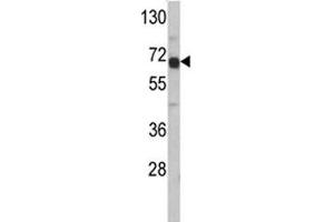 Western blot analysis of AFP antibody and HepG2 lysate. (alpha Fetoprotein anticorps  (AA 56-85))