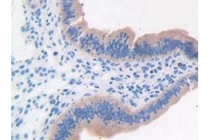 Detection of LRG1 in Mouse Uterus Tissue using Polyclonal Antibody to Leucine Rich Alpha-2-Glycoprotein 1 (LRG1)