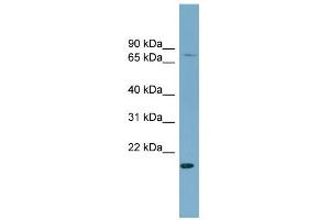 WB Suggested Anti-PDZRN4 Antibody Titration:  0. (PDZRN4 anticorps  (N-Term))
