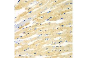 Immunohistochemistry of paraffin-embedded rat heart using PDE4DIP antibody at dilution of 1:100 (40x lens). (PDE4DIP anticorps)