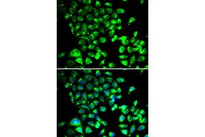 Immunofluorescence analysis of U2OS cells using SSBP1 antibody (ABIN5974202). (SSBP1 anticorps)