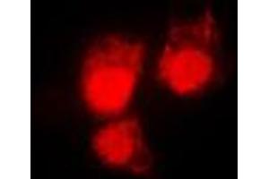 Immunofluorescent analysis of CDC2 (pT161) staining in HeLa cells. (CDK1 anticorps  (pSer161))