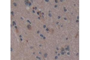 Figure. (PLA2G4D anticorps  (AA 9-120))