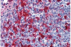 Human Tonsil: Formalin-Fixed, Paraffin-Embedded (FFPE) (Gelsolin anticorps  (AA 542-591))