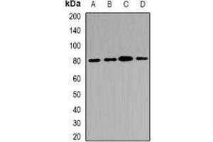 Western blot analysis of ABCB8 expression in Hela (A), HepG2 (B), mouse kidney (C), rat heart (D) whole cell lysates. (ABCB8 anticorps)