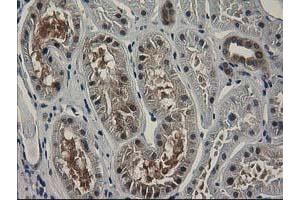 Image no. 13 for anti-Sepiapterin Reductase (SPR) antibody (ABIN1501111)