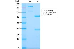 SDS-PAGE Analysis Purified CD79b Recombinant Rabbit Monoclonal Antibody (IGB/2940R). (Recombinant CD79b anticorps  (AA 29-159))