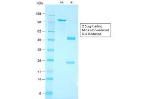 SDS-PAGE analysis of purified, BSA-free recombinant CD79a antibody (clone IGA/1790R) as confirmation of integrity and purity. (Recombinant CD79a anticorps  (AA 202-216))