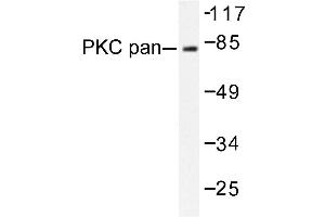 Image no. 1 for anti-Protein Kinase C, alpha (PKCa) antibody (ABIN272065) (PKC alpha anticorps)