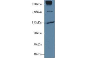 Western blot analysis of Human MCF7 cell lysate, using CDHE Antibody (1 µg/ml) and HRP-conjugated Goat Anti-Rabbit antibody (abx400043, 0.