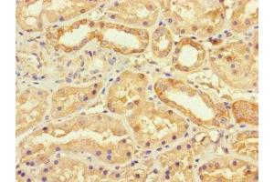 Immunohistochemistry of paraffin-embedded human kidney tissue using ABIN7175490 at dilution of 1:100 (SEC22A anticorps  (AA 10-187))
