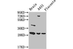 Western Blot Positive WB detected in: Mouse brain tissue, A431 whole cell lysate, Human placenta tissue All lanes: YWHAG antibody at 3.