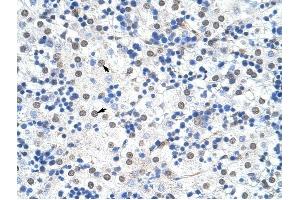IKZF3 antibody was used for immunohistochemistry at a concentration of 4-8 ug/ml to stain Hepatocytes (arrows) in Human Liver.