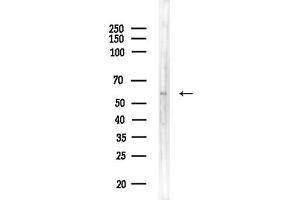 anti-Zinc Finger Protein 306 (ZKSCAN3) (Internal Region) antibody