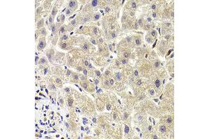 Immunohistochemistry of paraffin-embedded Human liver injury using AKT1S1 antibody at dilution of 1:100 (x400 lens). (PRAS40 anticorps)