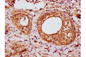 anti-Iroquois Homeobox 6 (IRX6) (AA 289-389) antibody