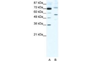WB Suggested Anti-SIRT3 Antibody Titration:  2. (SIRT3 anticorps  (Middle Region))
