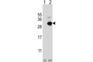 Western Blotting (WB) image for anti-Glutathione S-Transferase omega 1 (GSTO1) antibody (ABIN3001725) (GSTO1 anticorps)