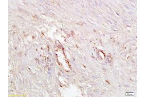 Formalin-fixed and paraffin embedded human endometrial tissue labeled with Anti ICAM4 Polyclonal Antibody, Unconjugated (ABIN873300) at 1:200 followed by conjugation to the secondary antibody and DAB staining (ICAM4 anticorps  (AA 85-180))
