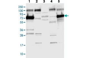 Western blot analysis of Lane 1: RT-4, Lane 2: U-251 MG, Lane 3: Human Plasma, Lane 4: Liver, Lane 5: Tonsil with SYTL1 polyclonal antibody .