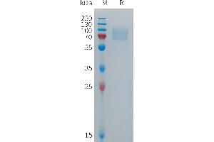 Human FB Protein, hFc Tag on SDS-PAGE under reducing condition.