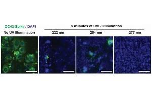 Infection of human lung cell line, HCT-8 from irradiated and untreated hCoV-OC43. (hCoV-OC43 Spike anticorps  (AA 15-344))
