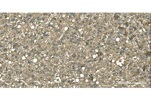 IHC analysis of Aspartate Aminotransferase/GOT1 using anti-Aspartate Aminotransferase/GOT1 antibody (ABIN7601883). (GOT1 anticorps  (AA 5-413))