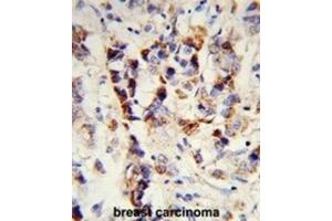 Immunohistochemistry (IHC) image for anti-Superkiller Viralicidic Activity 2-Like 2 (SKIV2L2) antibody (ABIN3003891)