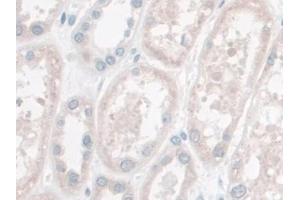 DAB staining on IHC-P; Samples: Human Kidney Tissue (LETMD1 anticorps  (AA 162-347))