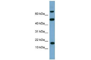 WB Suggested Anti-TSC22D1 Antibody Titration:  0. (TSC22D1 anticorps  (Middle Region))