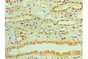Immunohistochemistry of paraffin-embedded human kidney tissue using ABIN7167832 at dilution of 1:100 (RDH11 anticorps  (AA 22-318))