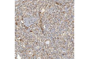 IHC analysis of TXNDC5 using anti-TXNDC5 antibody (ABIN7599699). (TXNDC5 anticorps  (AA 109-403))