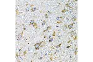 Immunohistochemistry of paraffin-embedded mouse brain using PDYN antibody (ABIN6129606, ABIN6145418, ABIN6145419 and ABIN6221524) at dilution of 1:100 (40x lens). (PDYN anticorps  (AA 21-254))