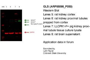 Western Blotting (WB) image for anti-Glutaminase (GLS) (C-Term) antibody (ABIN2786054)