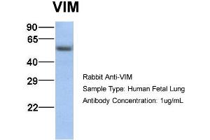 Host:  Rabbit  Target Name:  VIM  Sample Type:  Human Fetal Lung  Antibody Dilution:  1. (Vimentin anticorps  (C-Term))