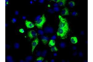 Anti-LOX mouse monoclonal antibody (ABIN2453266) immunofluorescent staining of COS7 cells transiently transfected by pCMV6-ENTRY LOX (RC213323). (LOX anticorps  (AA 22-168))
