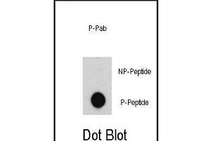 Dot blot analysis of anti-ABL-p Pab (R) on nitrocellulose membrane. (ABL1 anticorps  (pTyr204))