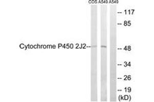 Western Blotting (WB) image for anti-Cytochrome P450, Family 2, Subfamily J, Polypeptide 2 (CYP2J2) (AA 231-280) antibody (ABIN2889947)