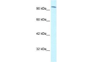 Human Jurkat; WB Suggested Anti-SMARCC1 Antibody Titration: 1. (SMARCC1 anticorps  (C-Term))