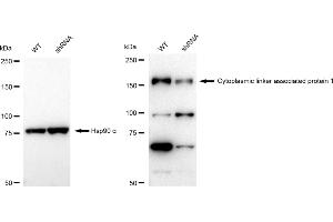 Western blotting analysis using Cytoplasmic linker associated protein 1 antibody (ABIN7798265). (Recombinant CLASP1 anticorps)