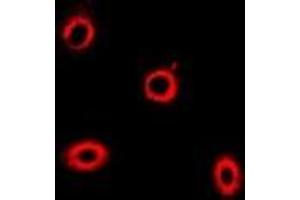 Immunofluorescent analysis of HIP1 staining in U2OS cells. (HIP1 anticorps)