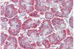 Human Pancreas: Formalin-Fixed, Paraffin-Embedded (FFPE)