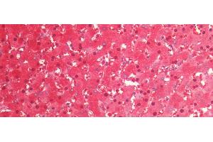 Detection of ARG in Human Liver Tissue using Monoclonal Antibody to Arginase (ARG)