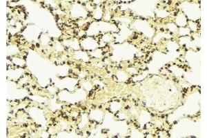 ABIN6274326 at 1/100 staining Mouse lung tissue by IHC-P. (AKAP13 anticorps  (Internal Region))