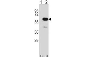 Western Blotting (WB) image for anti-Methionyl Aminopeptidase 2 (METAP2) antibody (ABIN2997955) (METAP2 anticorps)