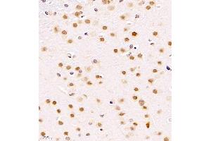 Immunohistochemistry of paraffin embedded rat brain using ZNF498 (ABIN7076253) at dilution of 1:4000 (400x lens)