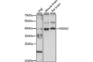 Western blot analysis of extracts of various cell lines, using FOXR2 antibody (ABIN7267250) at 1:1000 dilution. (FOXR2 anticorps  (AA 1-311))
