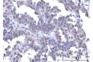 IHC analysis of RBM22 using anti-RBM22 antibody (ABIN7600268). (RBM22 anticorps  (AA 17-406))